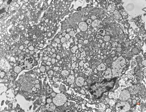 normal seromucinous salivary gland